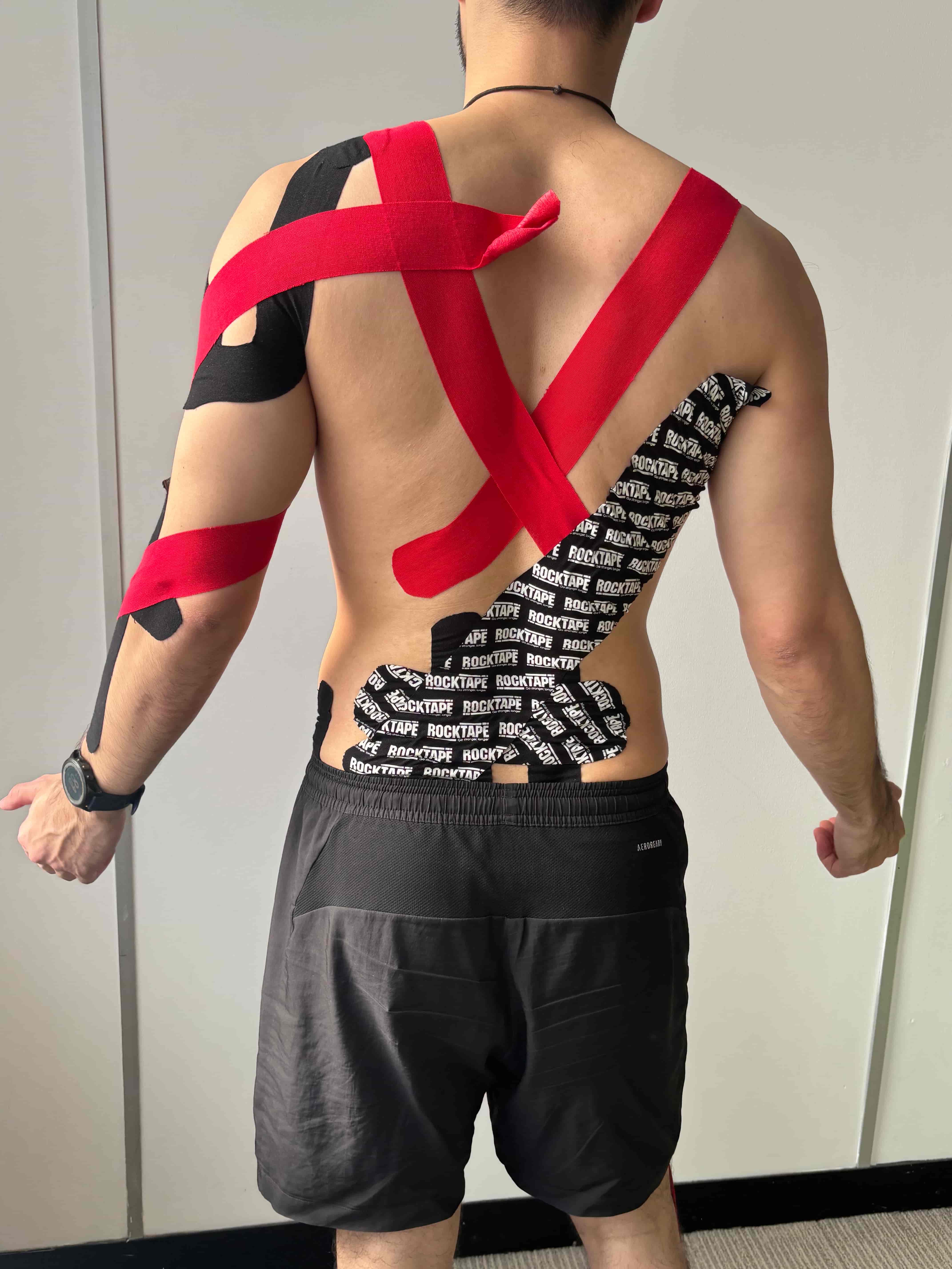 RockTape kinesiology taping applied after treatment